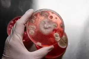Read more about the article Why Red Mercury Is Controversial in Science and Research