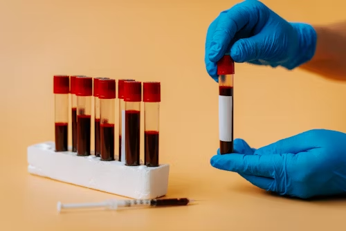 Read more about the article Mercure rouge de haute qualité avec rapports de tests de pureté vérifiés